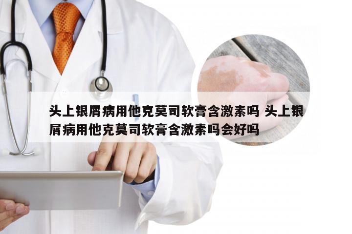 头上银屑病用他克莫司软膏含激素吗 头上银屑病用他克莫司软膏含激素吗会好吗
