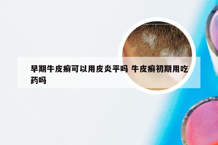 早期牛皮癣可以用皮炎平吗 牛皮癣初期用吃药吗