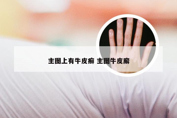 主图上有牛皮癣 主图牛皮廨