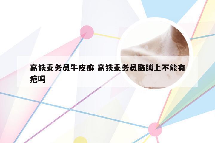 高铁乘务员牛皮癣 高铁乘务员胳膊上不能有疤吗