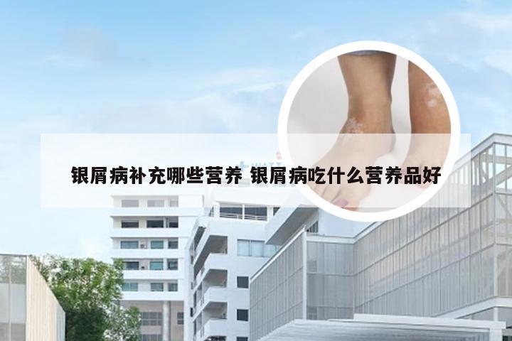 银屑病补充哪些营养 银屑病吃什么营养品好
