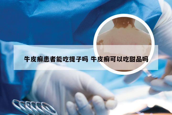 牛皮癣患者能吃提子吗 牛皮癣可以吃甜品吗