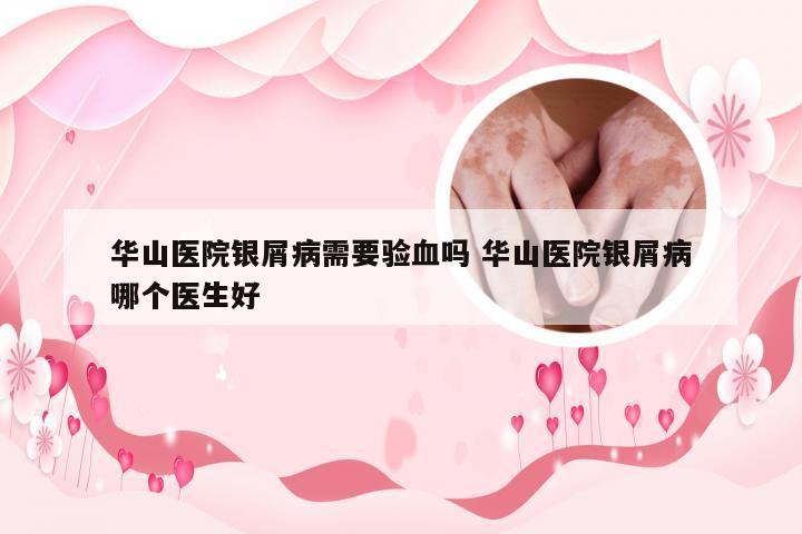 华山医院银屑病需要验血吗 华山医院银屑病哪个医生好